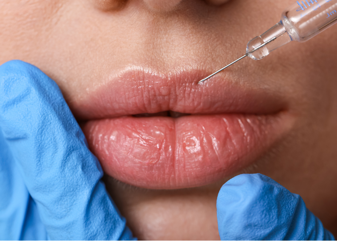 Anti-Ageing Techniques